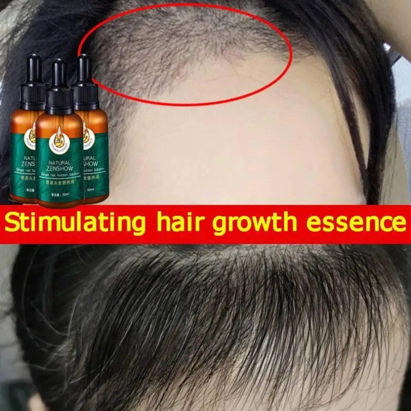 Zenzero crescita dei capelli o - Hair Care Herbal Products recensione e prezzo