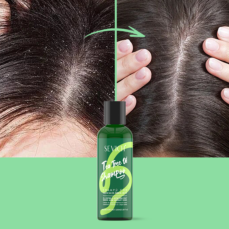 Tea Tree Essence Shampoo Balsa - Hair Care Set recensione e prezzo