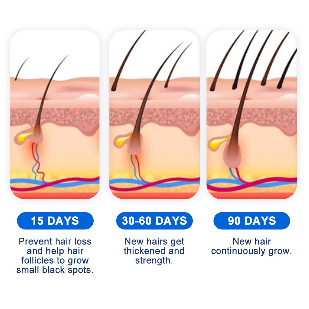 Alopecia Spray per la crescita - Hair Care Spray recensione e prezzo