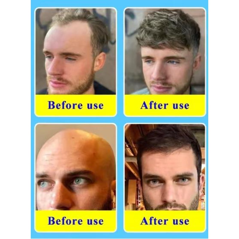 Olio Essenziale per la Cura de - Hair Care Vitamin recensione e prezzo