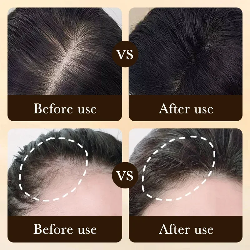 Olio per Crescita Rapida dei C - Hair Care Vitamin recensione e prezzo