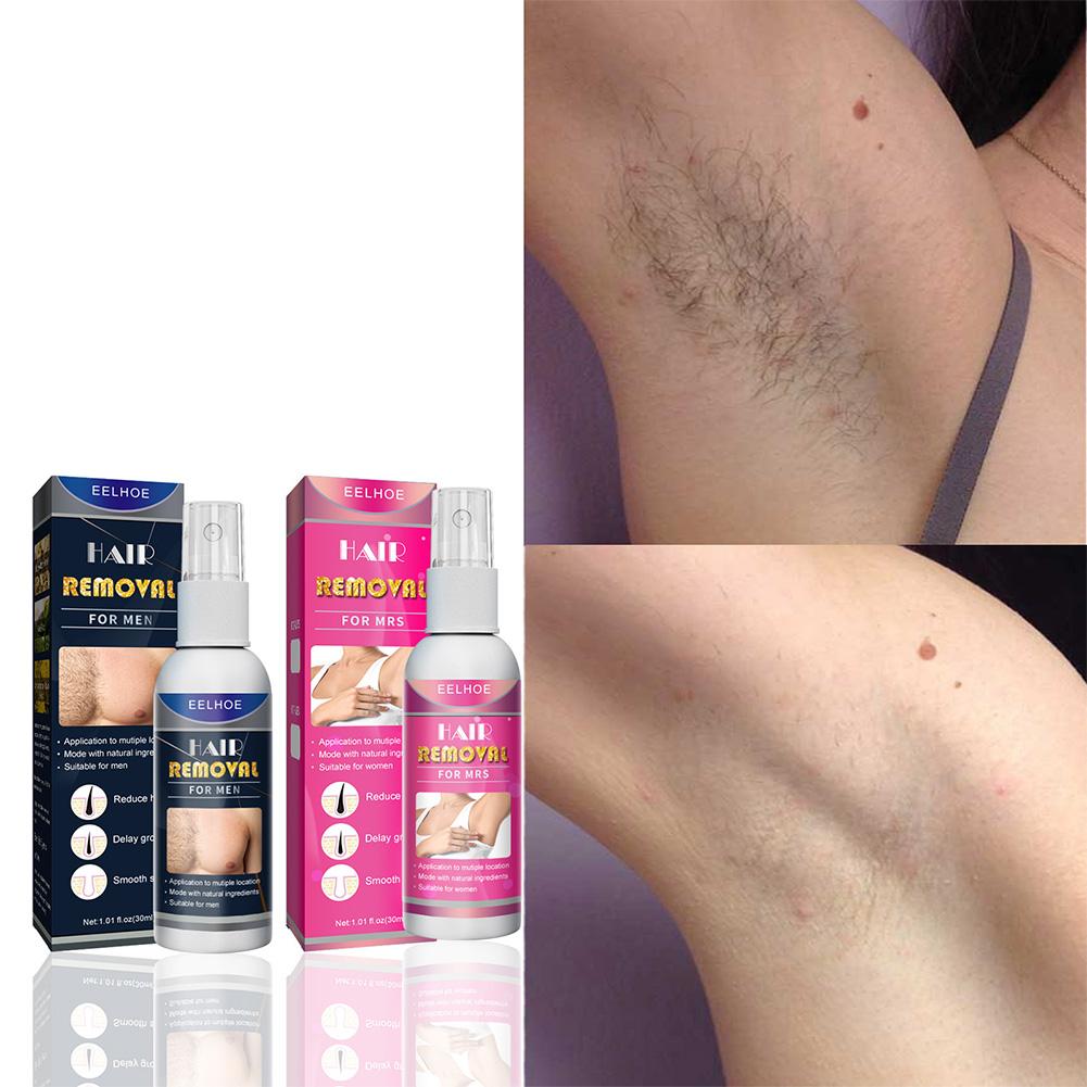 1/2PCS Super Naturale Indolore - Hair Care Spray recensione e prezzo