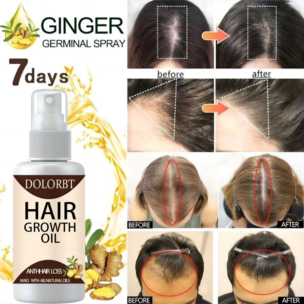 Essenza per la crescita dei ca - Hair Care Herbal Products recensione e prezzo