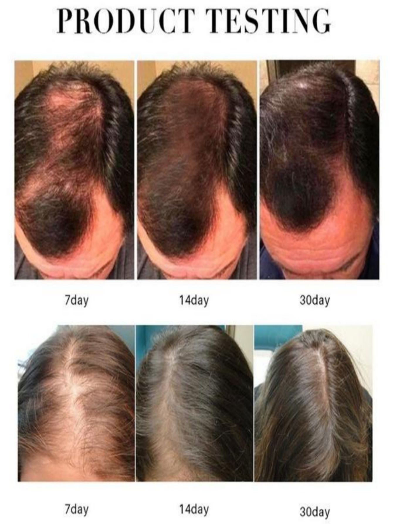 Essenza per la crescita dei ca - Hair Care Herbal Products recensione e prezzo
